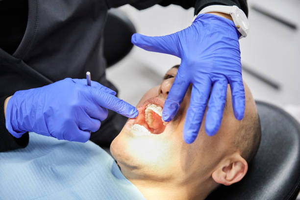 Best Knocked-Out Tooth (Avulsed Tooth) Treatment in Beverly, NJ